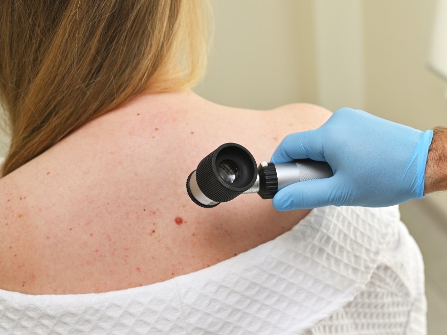 hospital de santa maria porto cancro de pele2